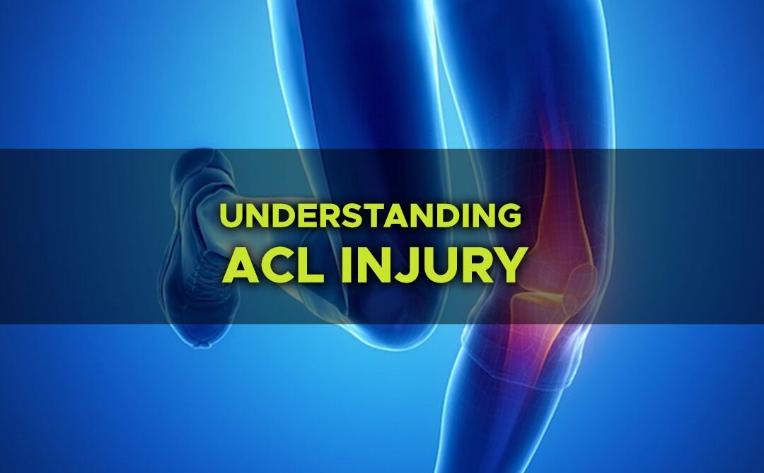 Understanding ACL Injury: How Physical Therapy Can Aid Recovery