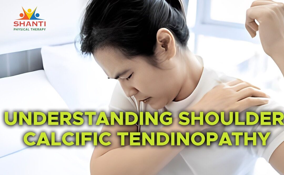 Understanding Shoulder Calcific Tendinopathy: Causes, Symptoms, and Treatment